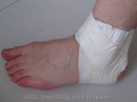 Taped Ankle